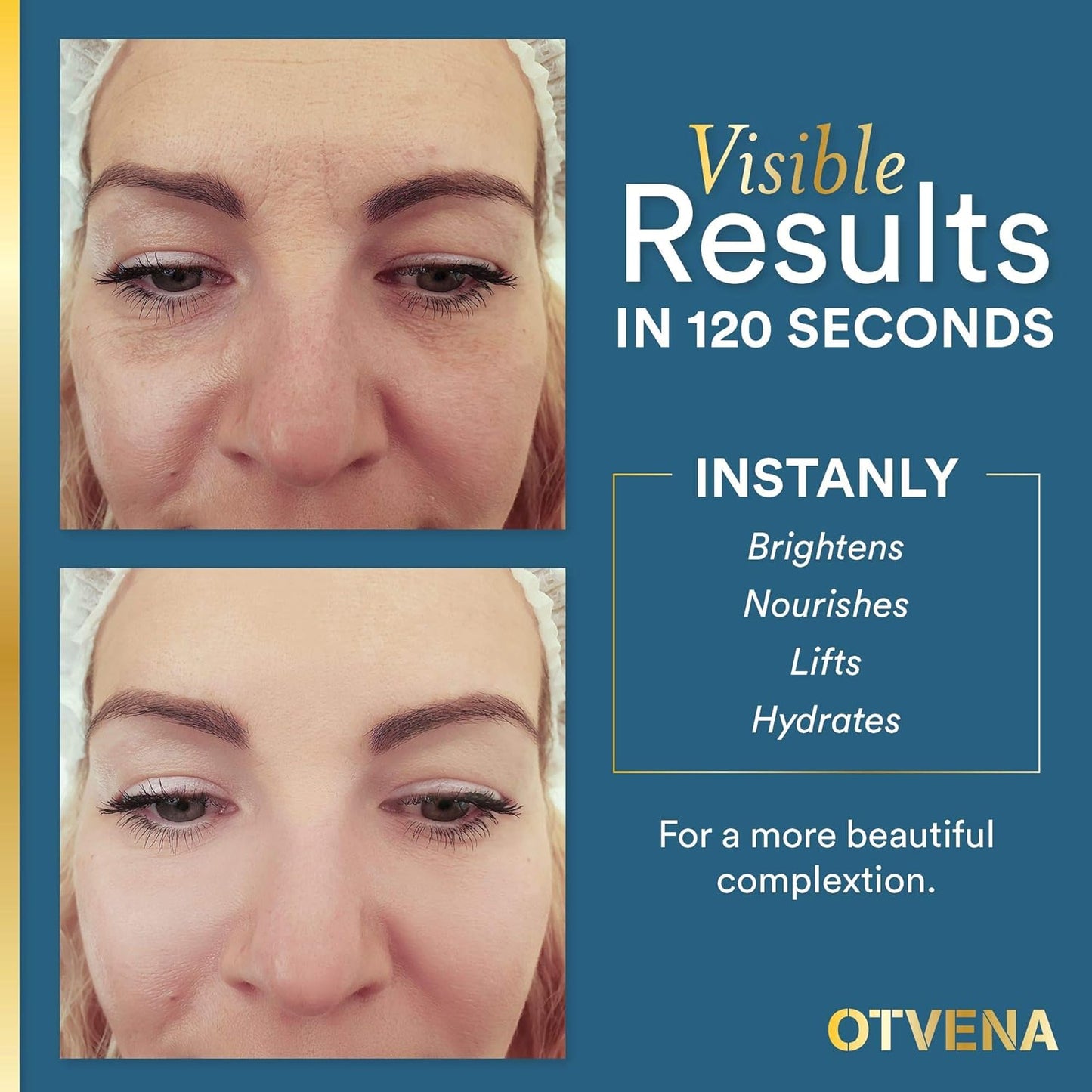 OTVENA ANTI AGING EYE CREAM